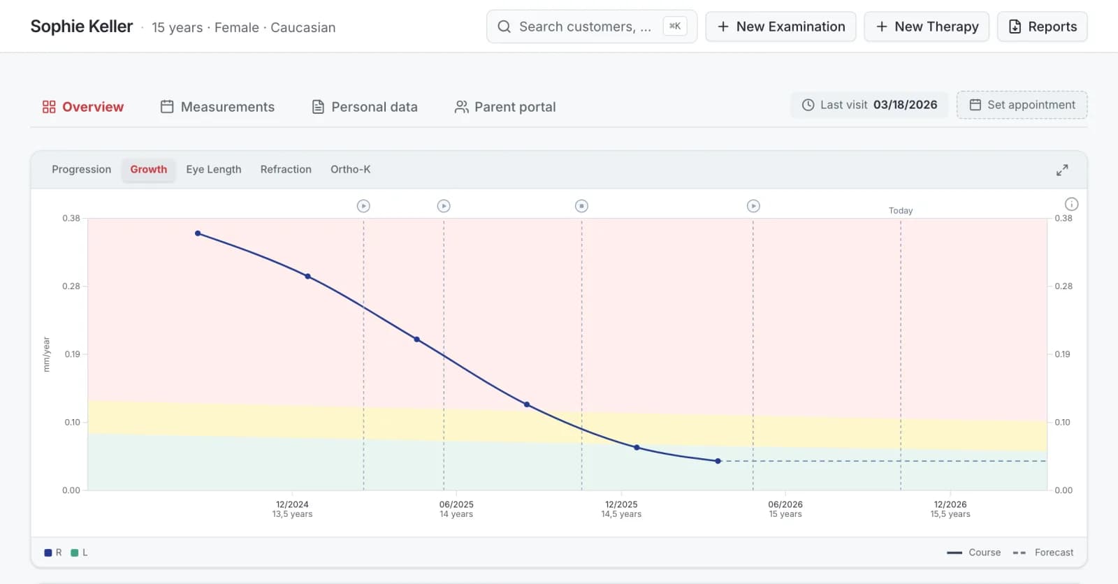 Practice app, Growth tab: axial length growth in mm per year falls into the green zone after therapy starts, with therapy markers and forecast, demo data